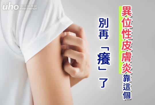 別再「癢」了!異位性皮膚炎靠這個
