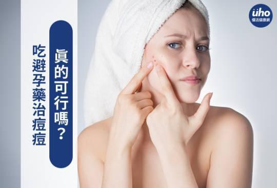 吃避孕藥治痘痘 真的可行嗎?