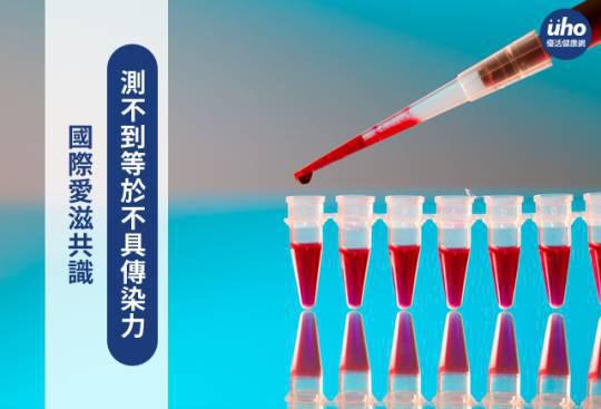 國際愛滋共識 測不到等於不具傳染力