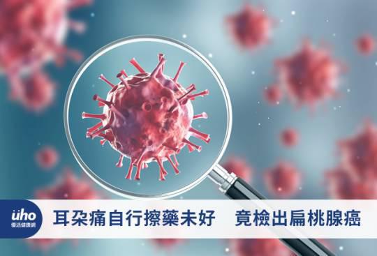 耳朵痛自行擦藥未好 竟檢出扁桃腺癌
