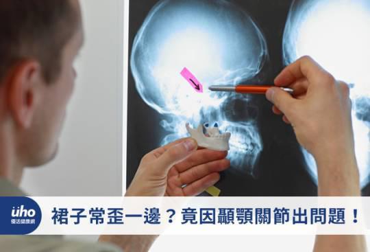 裙子常歪一边?竟因颞颚关节出问题!
