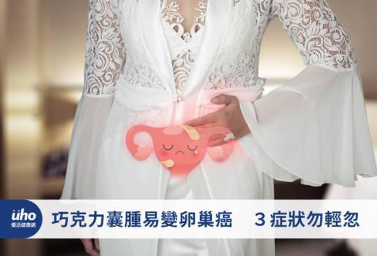 巧克力囊肿易变卵巢癌 3症状勿轻忽
