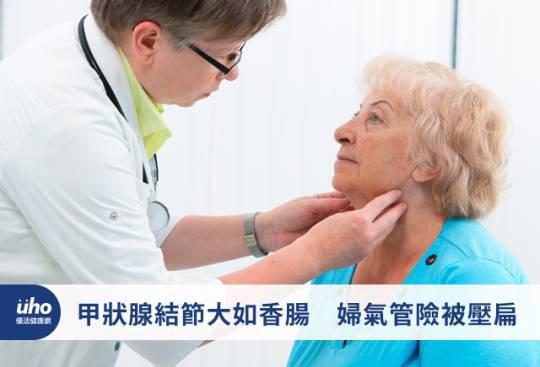 甲狀腺結節大如香腸 婦氣管險被壓扁