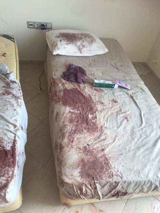 希金森房内的床单、墙壁、地板血迹斑斑,她也被打到不成人形。图/取自《太阳报》