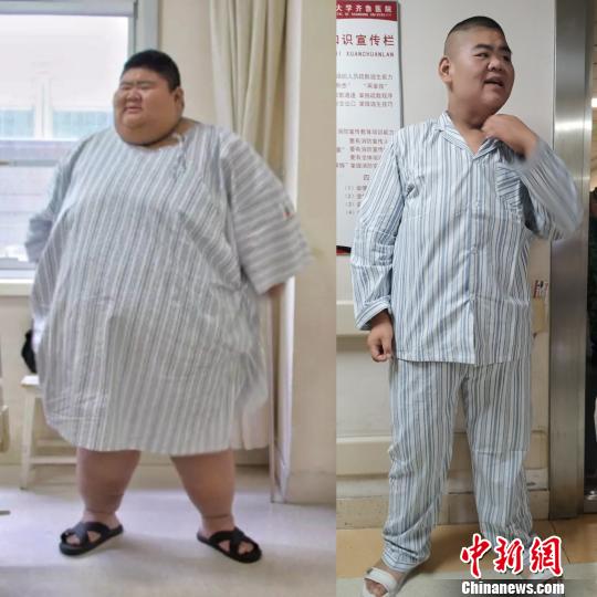 圖爲王浩楠減肥前後對比圖。左爲668斤,右爲268斤。(拼圖) 郝學娟 攝
