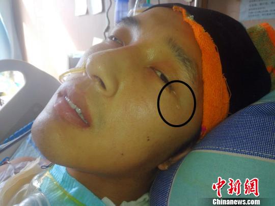 张辉所在的山西太谷消防大队、中队全体队友,连续41天深情呼唤,终于将其唤醒。图为张辉看见自己的队友时流泪。 陆祁国 摄
